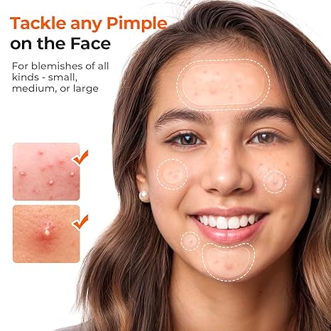 Hydrocolloid Pimple Patches 443 Count | 5 Sizes for Face & Body | Acne Patch for Whiteheads, Zits & Blemishes, All Skin Types